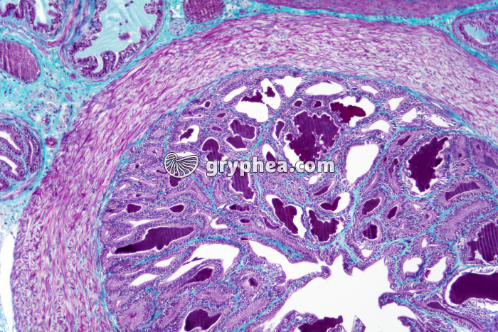 Vésicule séminale CT x25 - gryphea.com